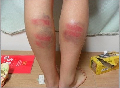 어느 정도의 체벌은 필요하다 vs 아니다 체벌은 절대 하면 안된다 | 인스티즈