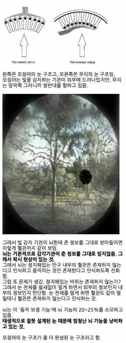 잘못 설계된 인간의 눈 | 인스티즈