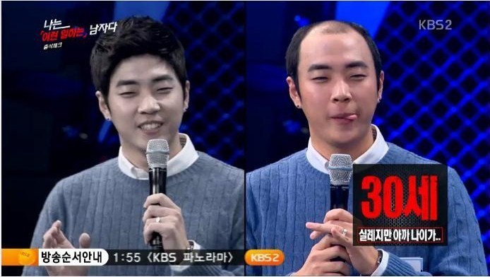 30세 탈모남 가발의 위엄.jpg | 인스티즈