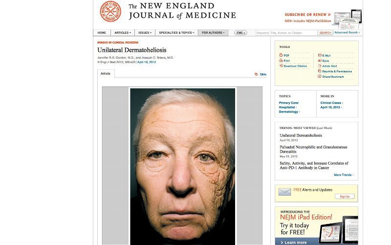 썬크림을 발라야하는 이유.jpg | 인스티즈