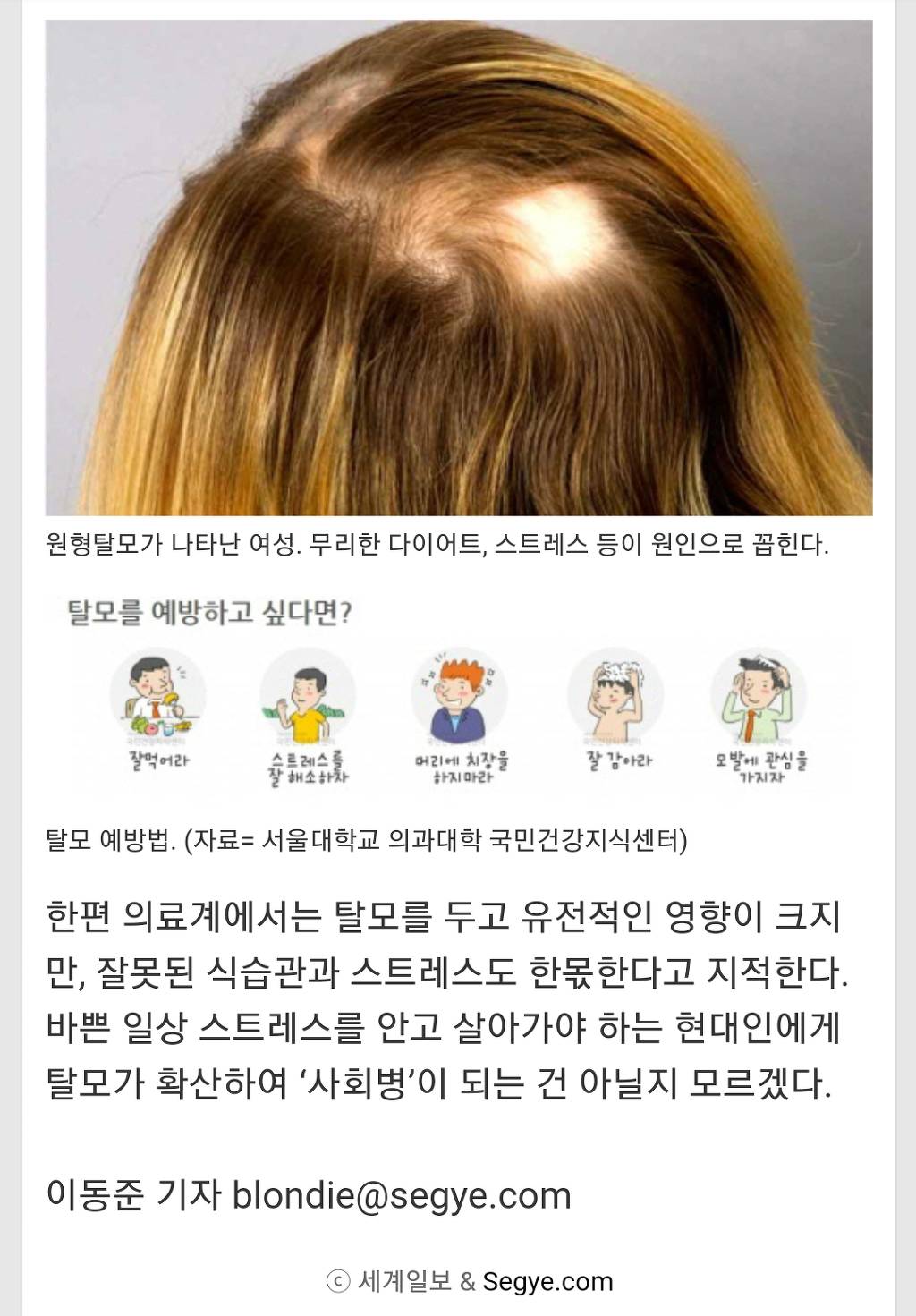 탈모인 1천만시대 | 인스티즈