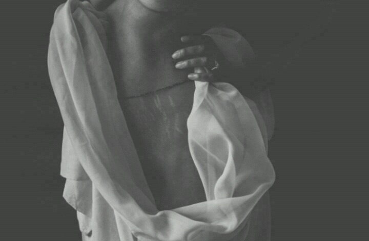 피부 튼살로 고민이 많은 여시들이 봐줬으면 하는 글 | 인스티즈