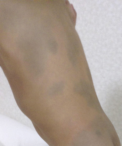 일본기자가 말하는 후쿠시마 방사능 피해 상황.jpg | 인스티즈