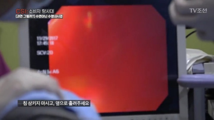 사람들이 수면 내시경 하는 이유.jpg | 인스티즈