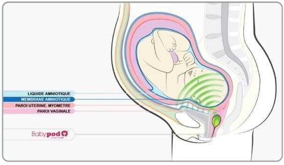 태아 이어폰 | 인스티즈