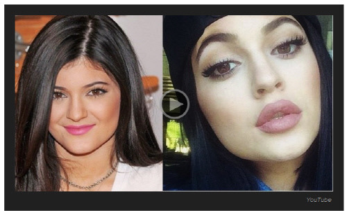 성형수술 하나 했는데 엄청 인기 많아진 여자 | 인스티즈