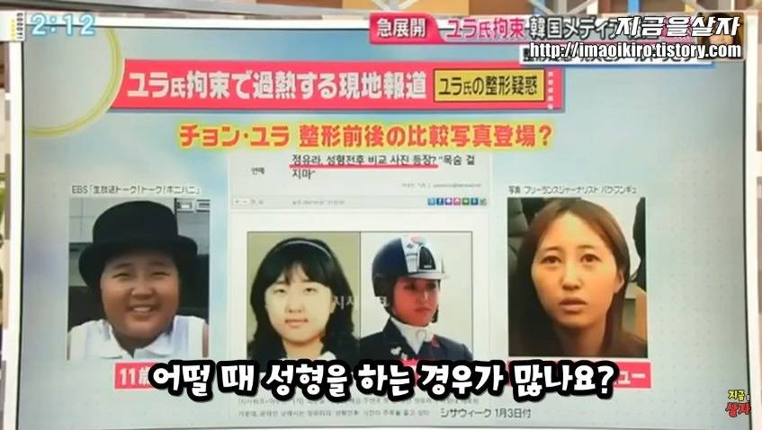 일본에서 한국인들 성형 많이한다고 낙인찍힘.jpg | 인스티즈