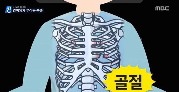 日本 안마 의자 부작용 | 인스티즈