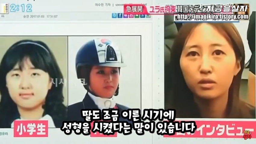 일본에서 한국인들 성형 많이한다고 낙인찍힘.jpg | 인스티즈