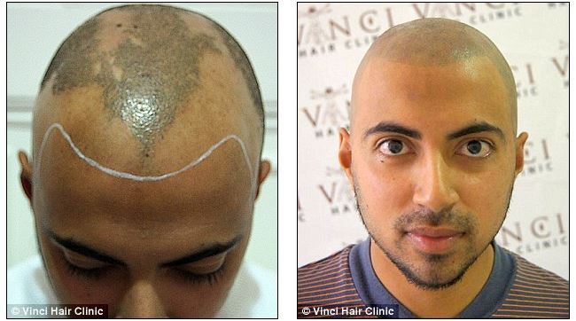 착한 문신.jpg | 인스티즈