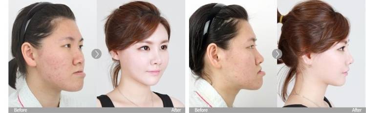 레알 역대급 렛미인 변신 ㅎㄷㄷㄷㄷㄷ | 인스티즈