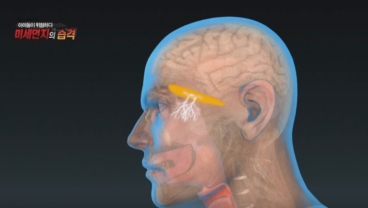 미세먼지가 위험한 진짜 이유 | 인스티즈