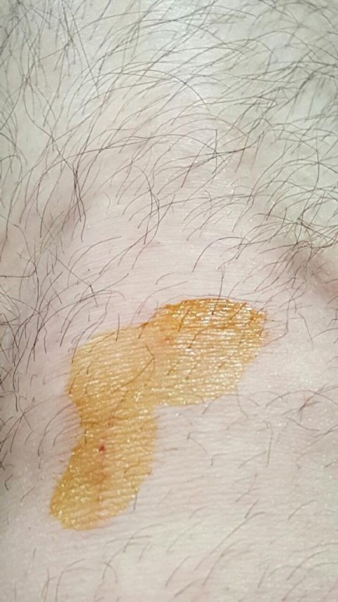 [판] +추가 강아지에게물린 배달원 합의금 사진 | 인스티즈