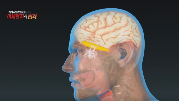 미세먼지가 위험한 진짜 이유 | 인스티즈