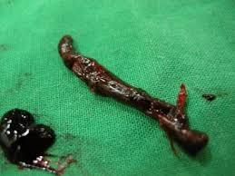 미세먼지가 위험한 진짜 이유 | 인스티즈