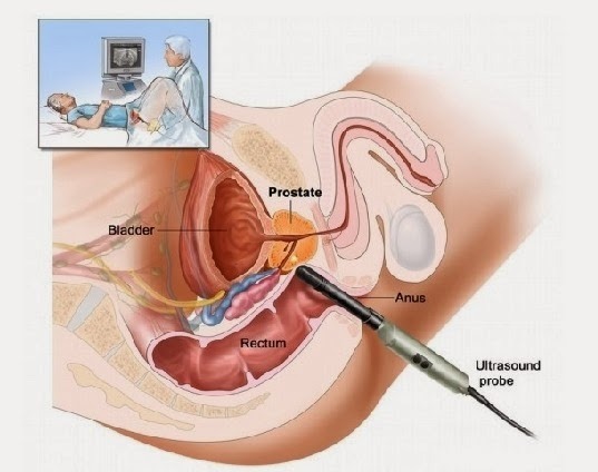 남자들이 가장 무서워하는 검사.jpg | 인스티즈