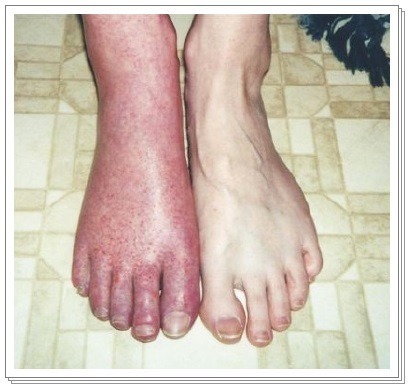 예비 군인들을 위한 군대에서 가장 조심해야 할일 (혐오주의).jpg | 인스티즈