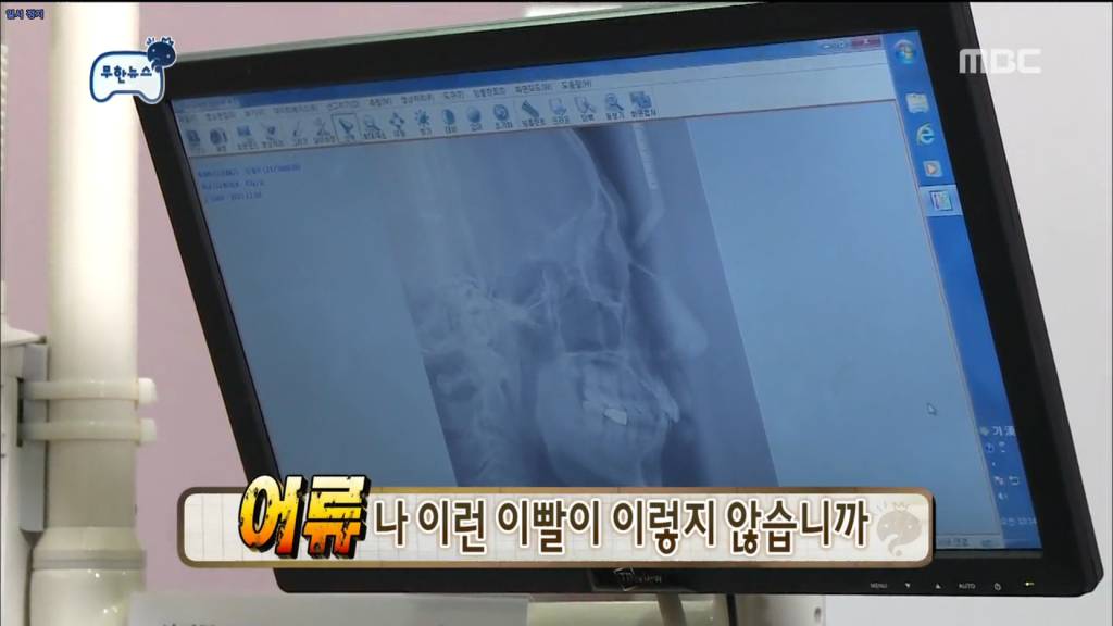 뼈속까지 못생김.JPG | 인스티즈