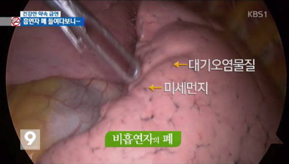 미세먼지가 위험한 진짜 이유 | 인스티즈