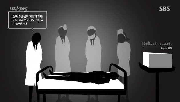 성형 수술 받은남자가 녹음한 의사들 잡담... | 인스티즈