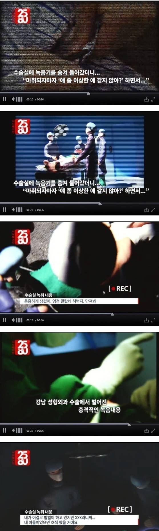 성형 수술 받은남자가 녹음한 의사들 잡담... | 인스티즈