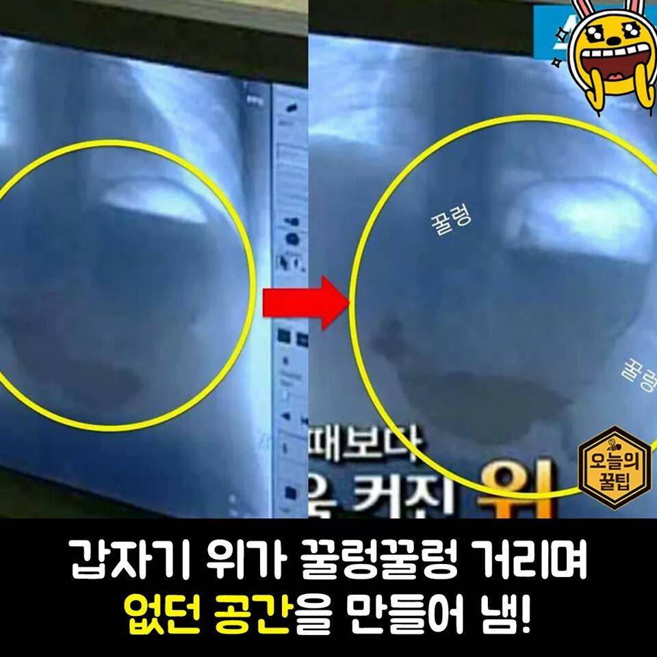 여자들이 밥먹고 또 간식을 먹는이유 | 인스티즈