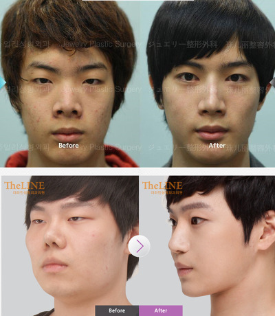 남자의 성형ㄷㄷㄷ | 인스티즈