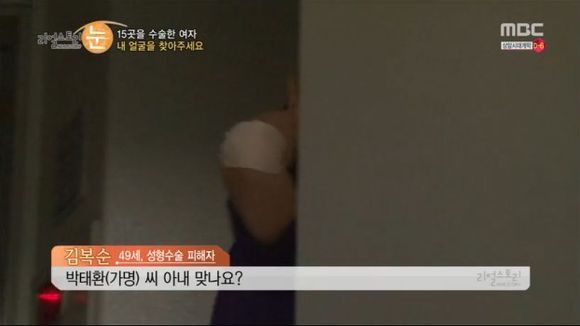 [리얼스토리눈] 15곳을 수술한 여자 내 얼굴을 찾아주세요 (성형수술 부작용) | 인스티즈