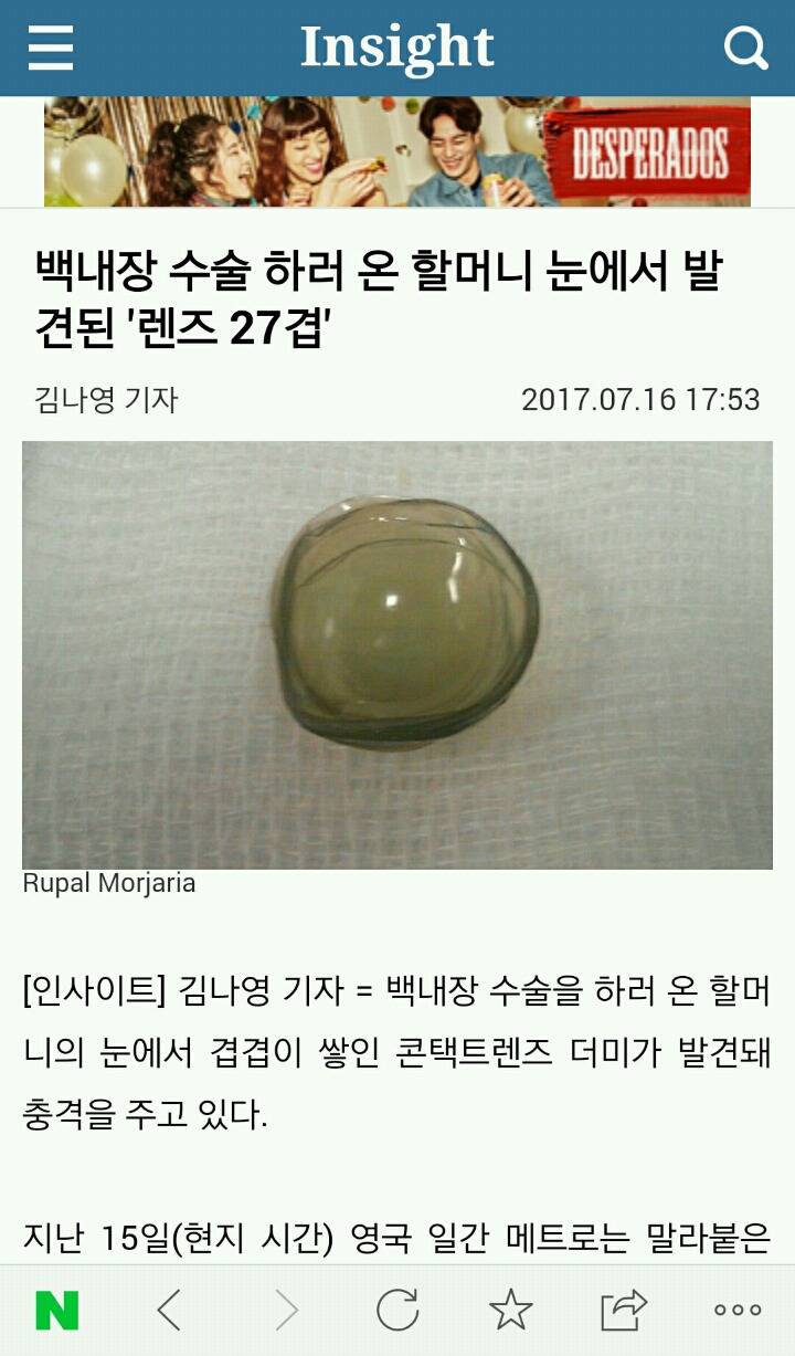 백내장 수술 하러 온 할머니 눈에서 발견된 '렌즈 27겹' | 인스티즈