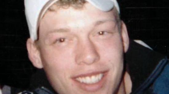 미국 미네소타 마요 클리닉에서 얼굴 이식술 성공 (혐오주의) | 인스티즈