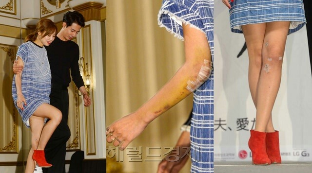 괜사에서 뜬금없이 여주인공(공효진)이 넘어져서 깁스한 설정이 나온 이유.jpg | 인스티즈