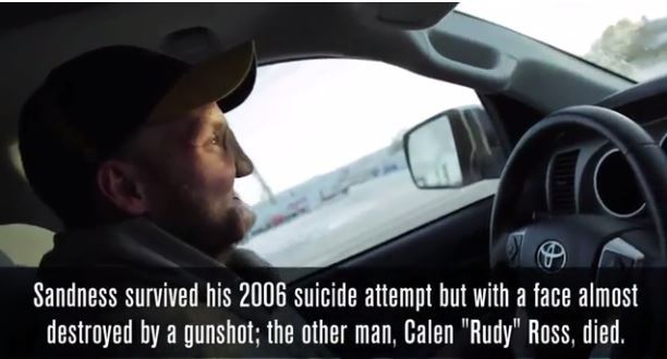 미국 미네소타 마요 클리닉에서 얼굴 이식술 성공 (혐오주의) | 인스티즈