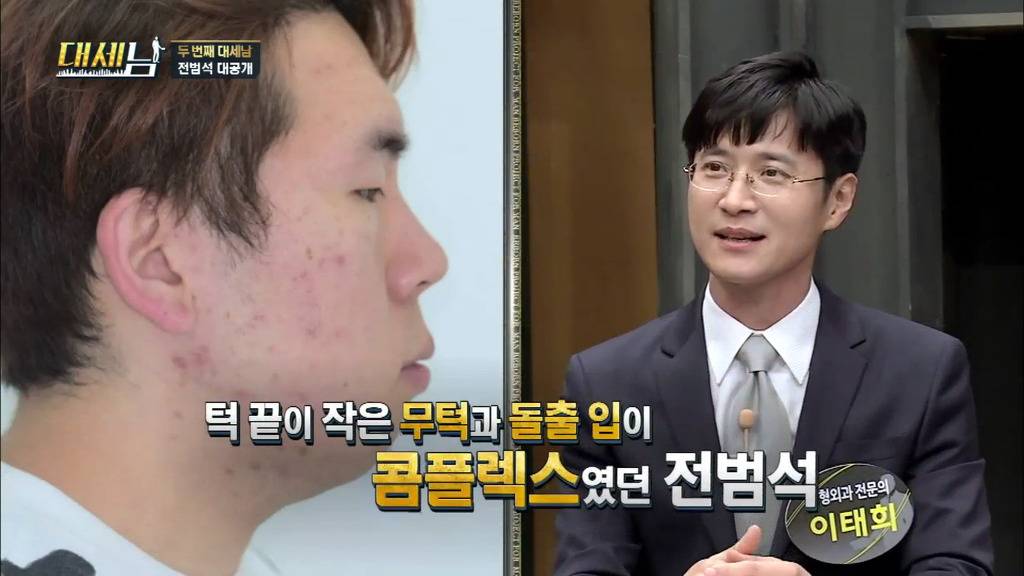 남자도 성형해야하는 EU | 인스티즈