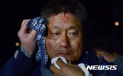 경찰이 휘두른 채증용 카메라에 부상 당한 농민(피 주의) | 인스티즈