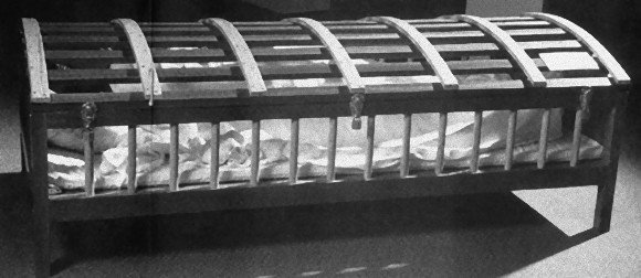 옛날에 실제로 사용되었던 의료기구들.JPG | 인스티즈