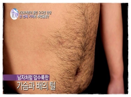 올여름이 오기전에 미리 블라질리언 왁싱을 알아봅시다.jpg | 인스티즈