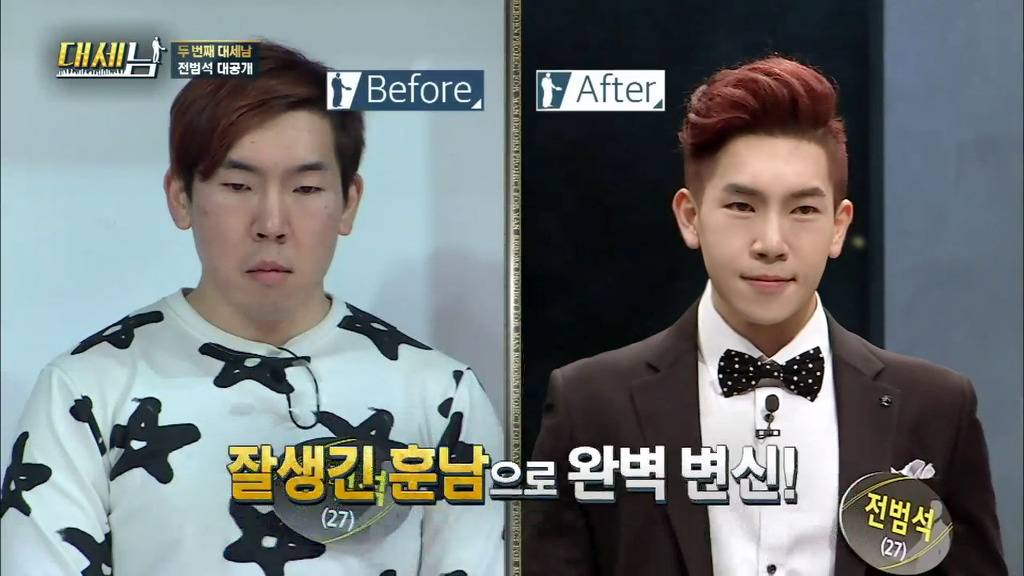 남자도 성형해야하는 EU | 인스티즈