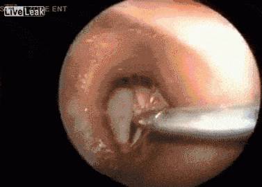 귀속에 벌레 | 인스티즈