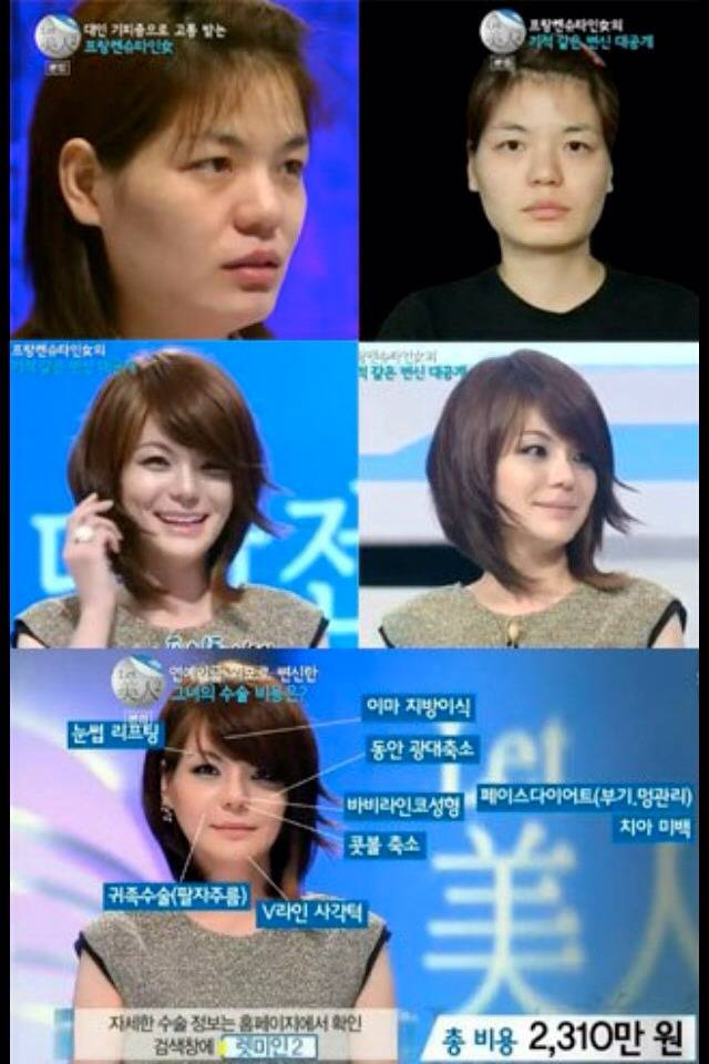 성형외과 근무자가 밝히는 성형에 대한 진솔한 이야기 | 인스티즈