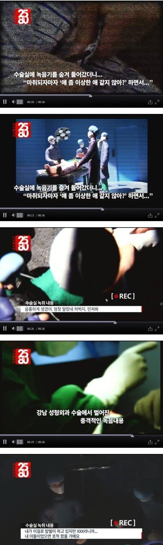 성형 수술한 남자가 녹음한 의사들 잡담 | 인스티즈