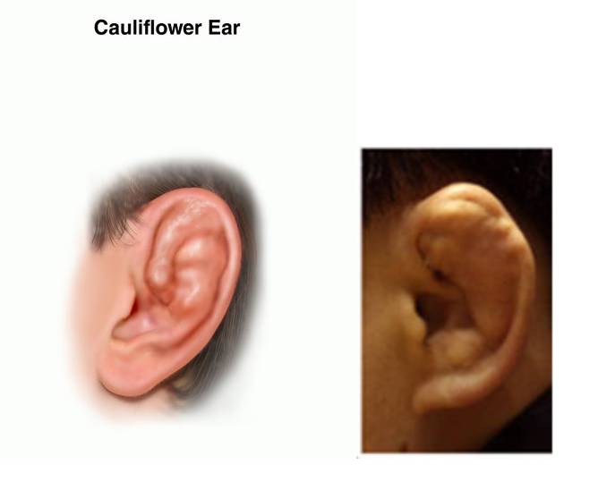 싸움이 났을때 피해야 하는 사람 유형 ..... jpg | 인스티즈