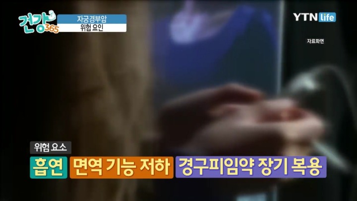 자궁경부암 위험요소.jpg | 인스티즈