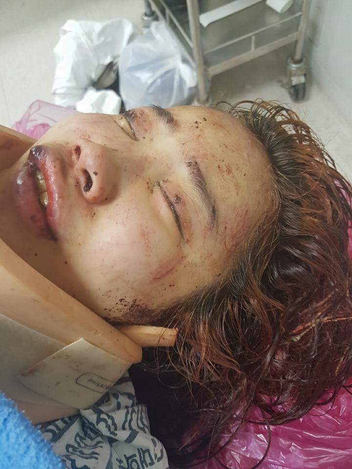 부산여중생폭행사건 피해자 사진 추가로 나온것.. | 인스티즈