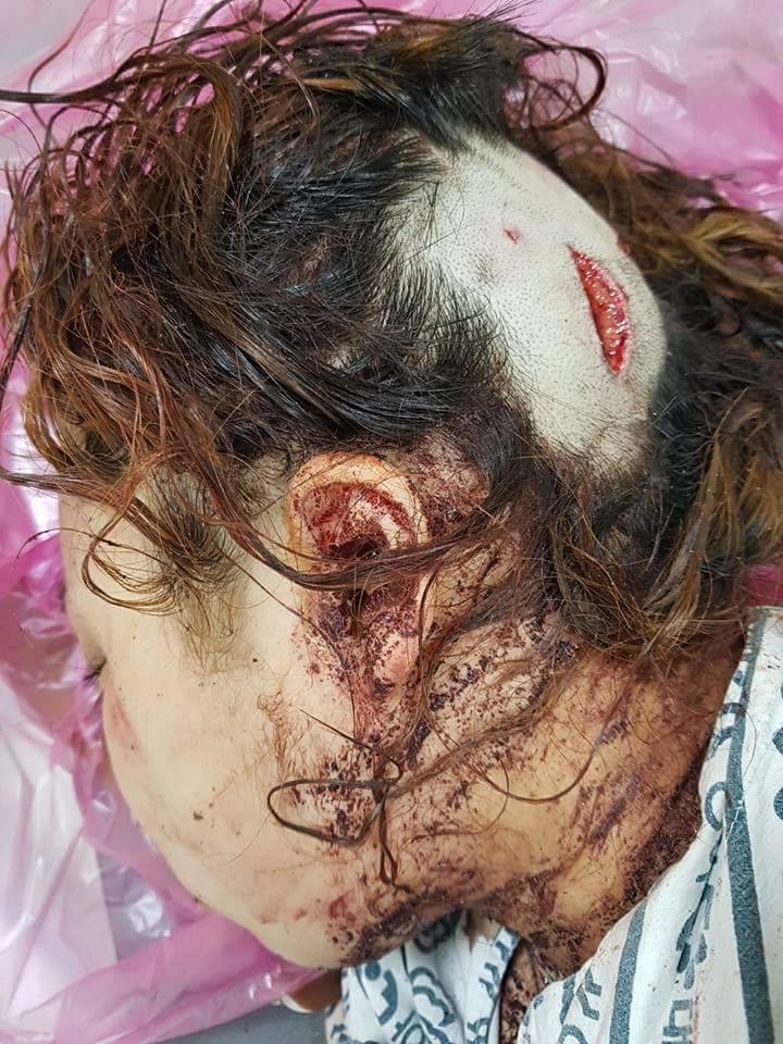 여중생 폭행사건의 진실(혐오주의) | 인스티즈