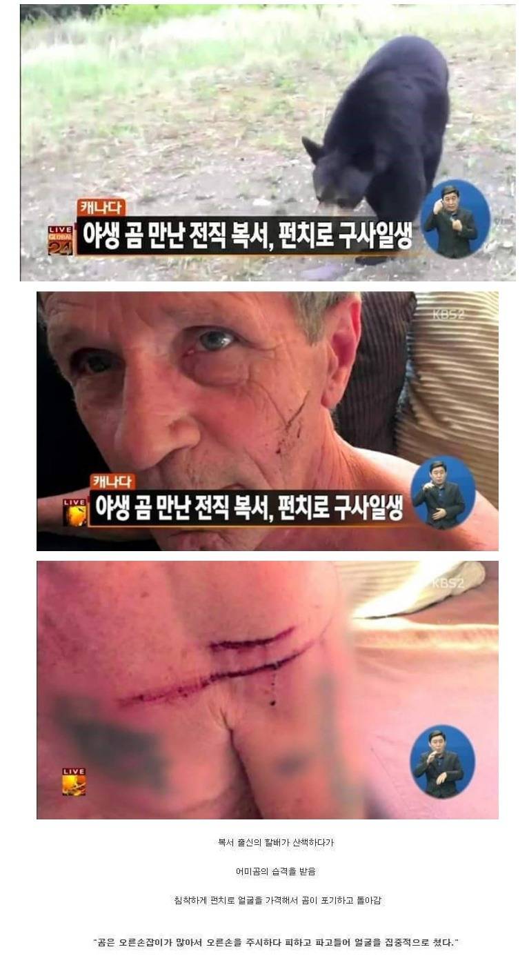 곰의 습격을 받은 할아버지.jpg | 인스티즈
