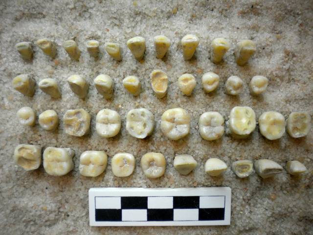 치대 들어가면 처음으로 배운다는 치아 구별하기(사진주의) | 인스티즈