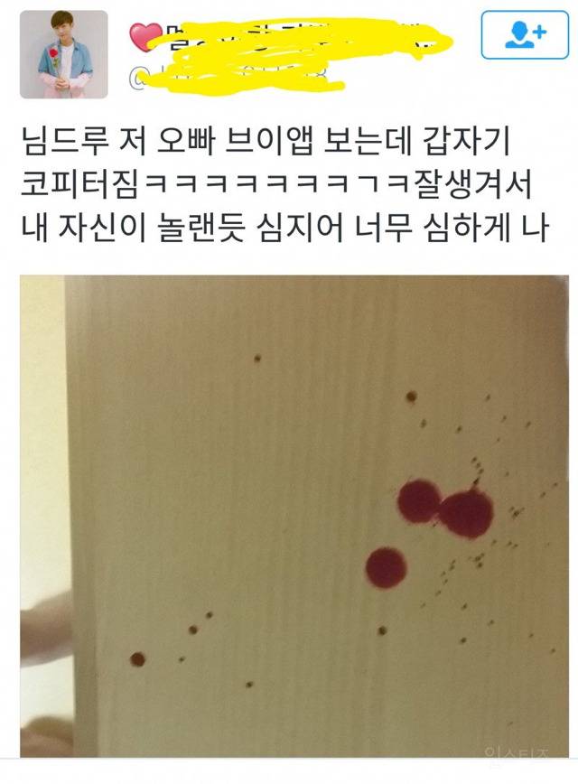 힘이 넘쳐나는 아이돌 팬들.jpg (피 주의) | 인스티즈