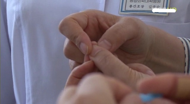 [MBC다큐] 북한으로 간 남한 의사들.JPG | 인스티즈