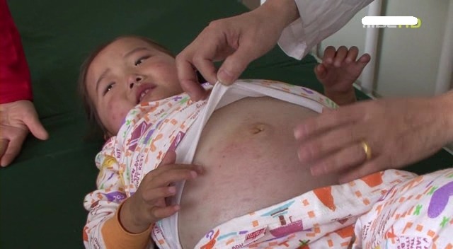 [MBC다큐] 북한으로 간 남한 의사들.JPG | 인스티즈