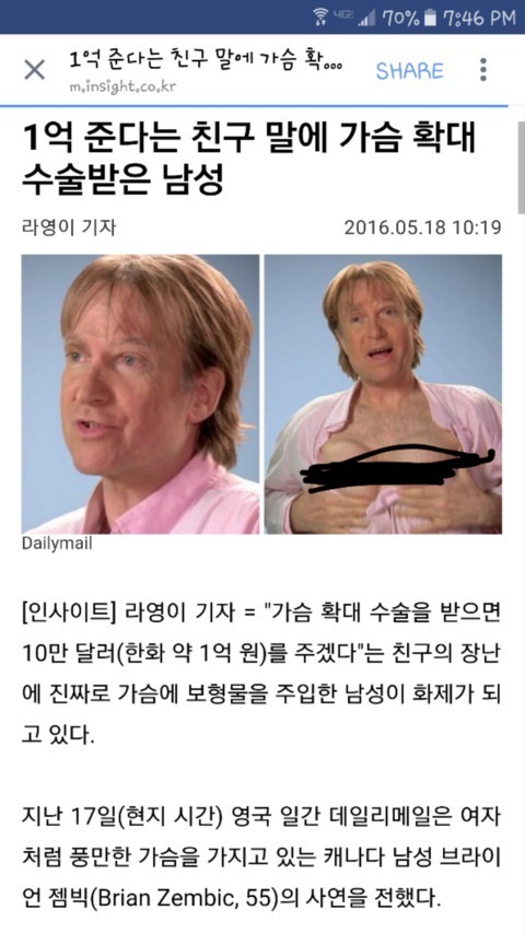 1억 준다는 말에 가슴 확대 수술한 남성 | 인스티즈